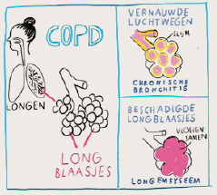 copd