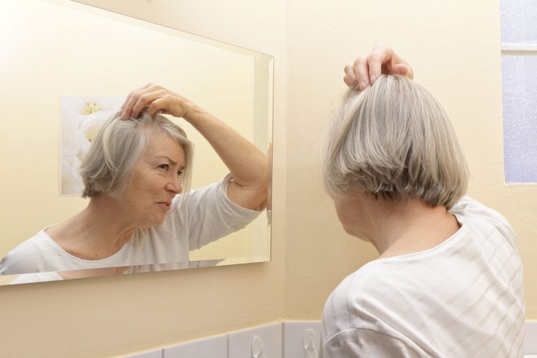 4 adviezen tegen haarverlies