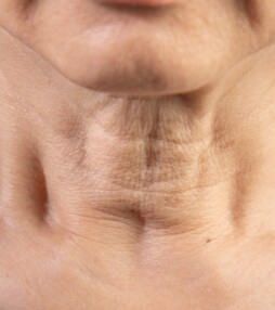 Beauty How To: slappe huid in de hals