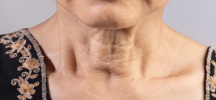 Beauty How To: slappe huid in de hals