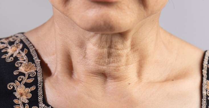 Beauty How To: slappe huid in de hals